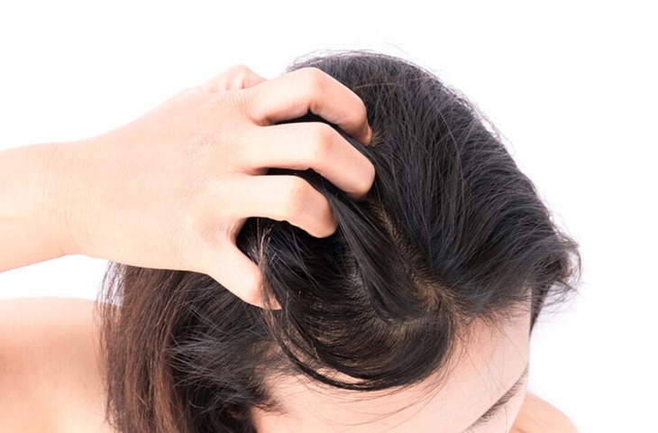 nguyên nhân tóc bị dầu nhờn